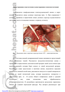 левосторонняя гемигепатэктомия