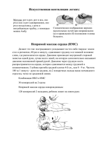 Искусственная вентиляция легких: Непрямой массаж сердца (НМС)