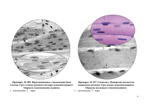 Препарат № 385. Веретеновидные гладкомышечные Препарат № 227. Симпласт. Поперечно-полосатое