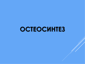 ОСТЕОСИНТЕЗ