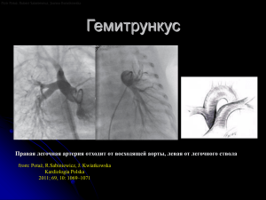 Гемитрункус