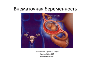 Внематочная беременность