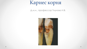 Кариес корня